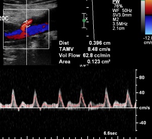 copy_lactate_fr__032483700_1632_10012013
